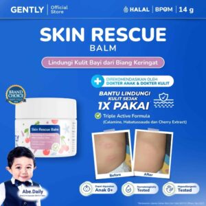 Skin Rescue Balm Lindungi kulit bayi dari biang keringat (1)